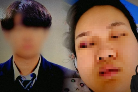 ‘거제 교제 살인’ 가해자 김 모 씨(왼쪽)와 피해자 故 이효정 씨의 생전 병원 입원 모습. [JTBC 보도화면]