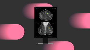루닛, AI로 유방암 발견율 증가 입증…국제 학술지 게재