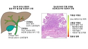 “5년 10명 중 7명 사망” 치명적 ‘담도암’…유전자검사로 조기진단길 열린다