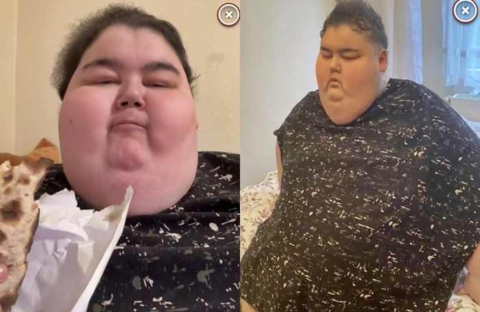 틱톡에서 먹방(먹는 방송)으로 유명해진 24세 튀르키예 스트리머가 비만으로 인한 합병증으로 사망했다. [틱톡]